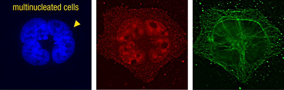 Fluorescent image showing multinucleated cells